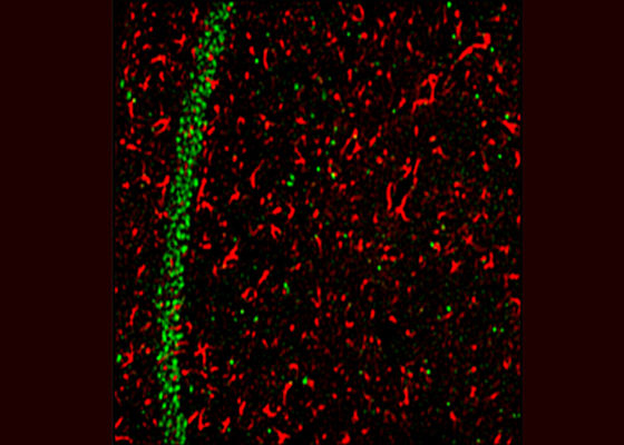 Studies on the Lafora disease mice models